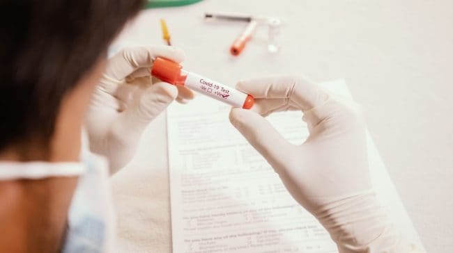 The US Approaches 5M Cases; California's Numbers Flawed Due By The Technical Glitch