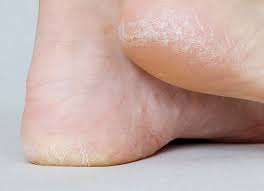 Kerasal-Intensive-Foot-Repair-cream
