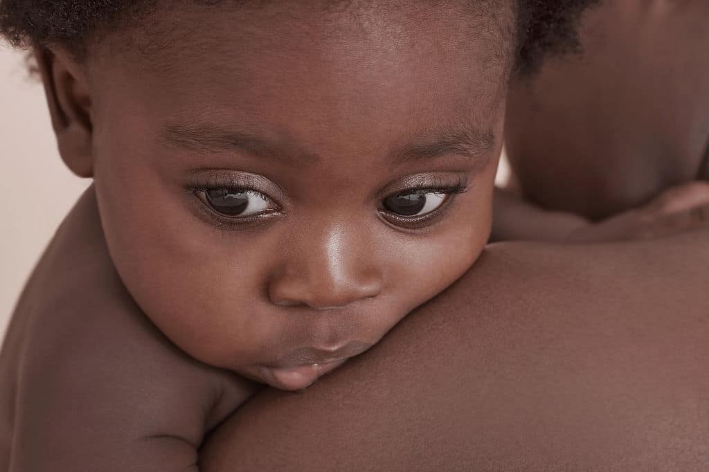 Address Maternal Morbidity: Reduce Racial Disparities