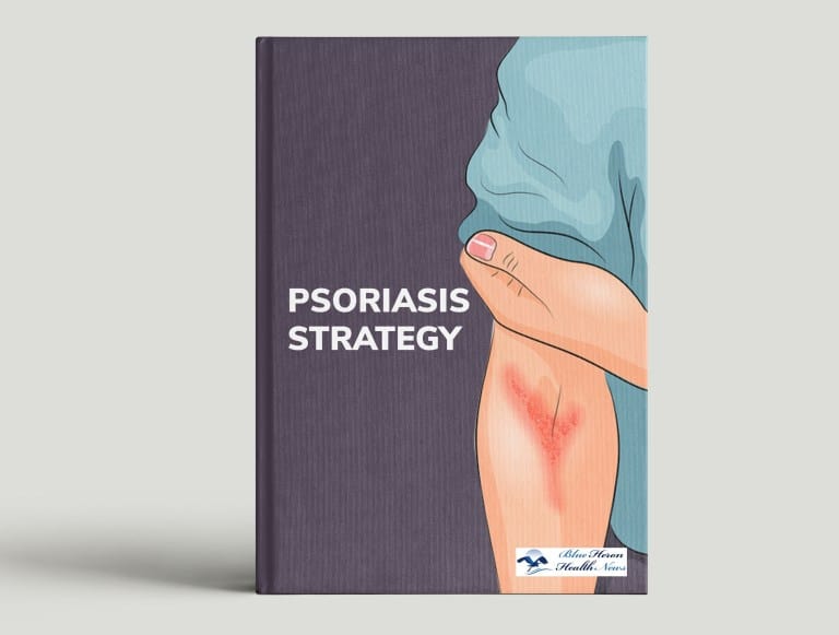 Features of Psoriasis Strategy