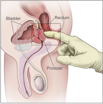 The Prostate Protocol benefits
