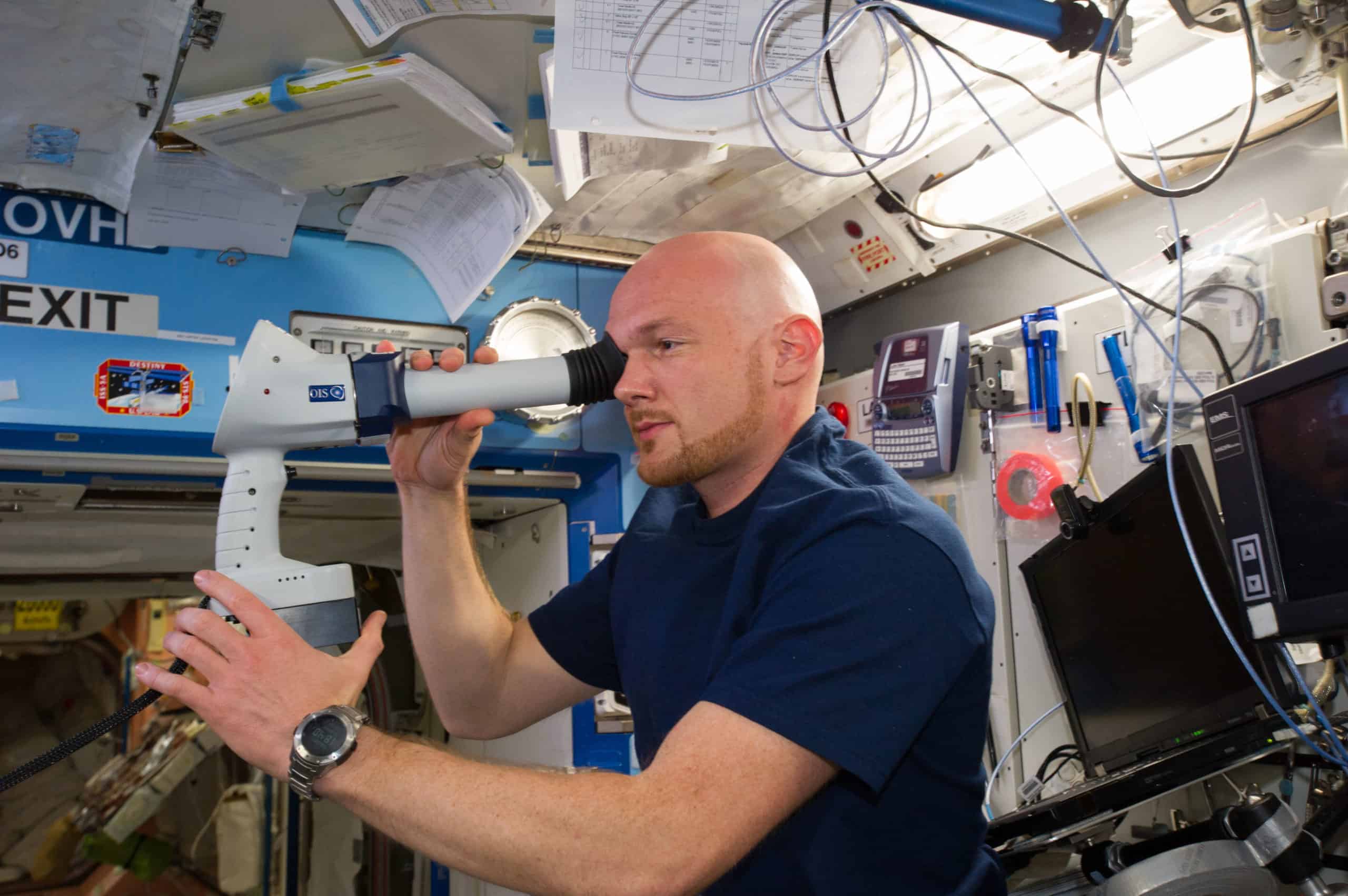 Being In Space Alters Human Eyes