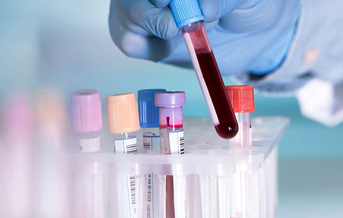 Can A Range Of Hidden Cancer Be Detected With A DNA Blood Sample?