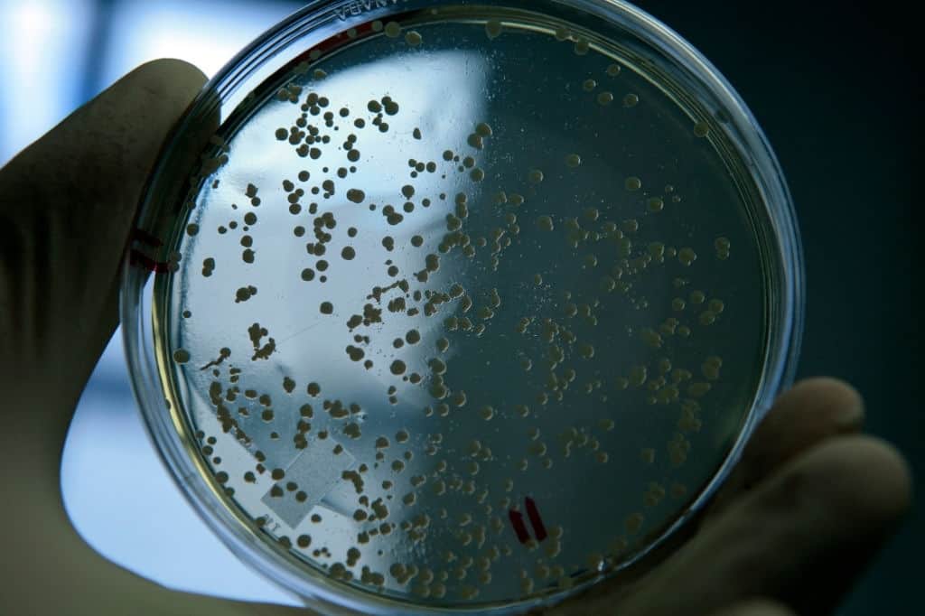 Antibiotic-Resistant Superbugs Could Spread In Clinics, According To A Research