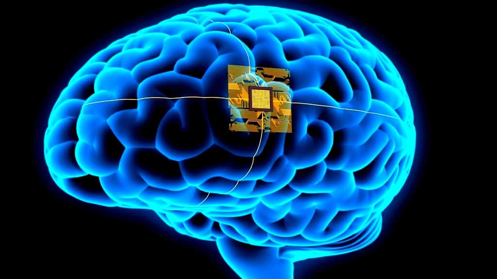 Brain Implant Helps Man 'Speak' Through A Computer