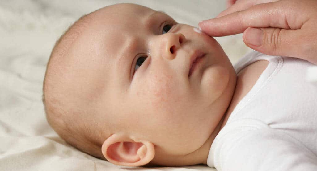 Surge In RSV Illness In Babies