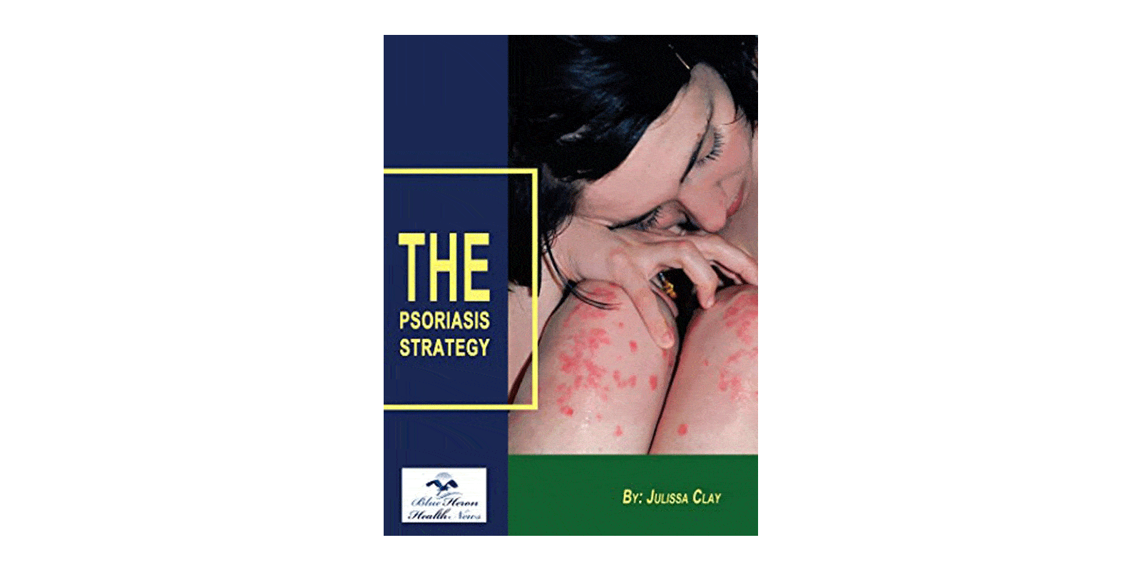 Psoriasis Strategy Reviews