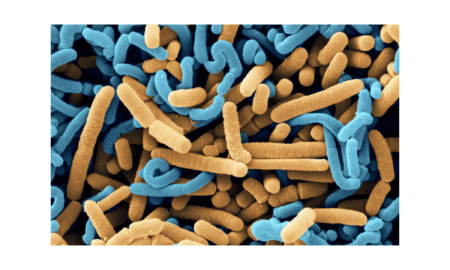 How Does Lactobacillus Acidophilus Protect The Gut