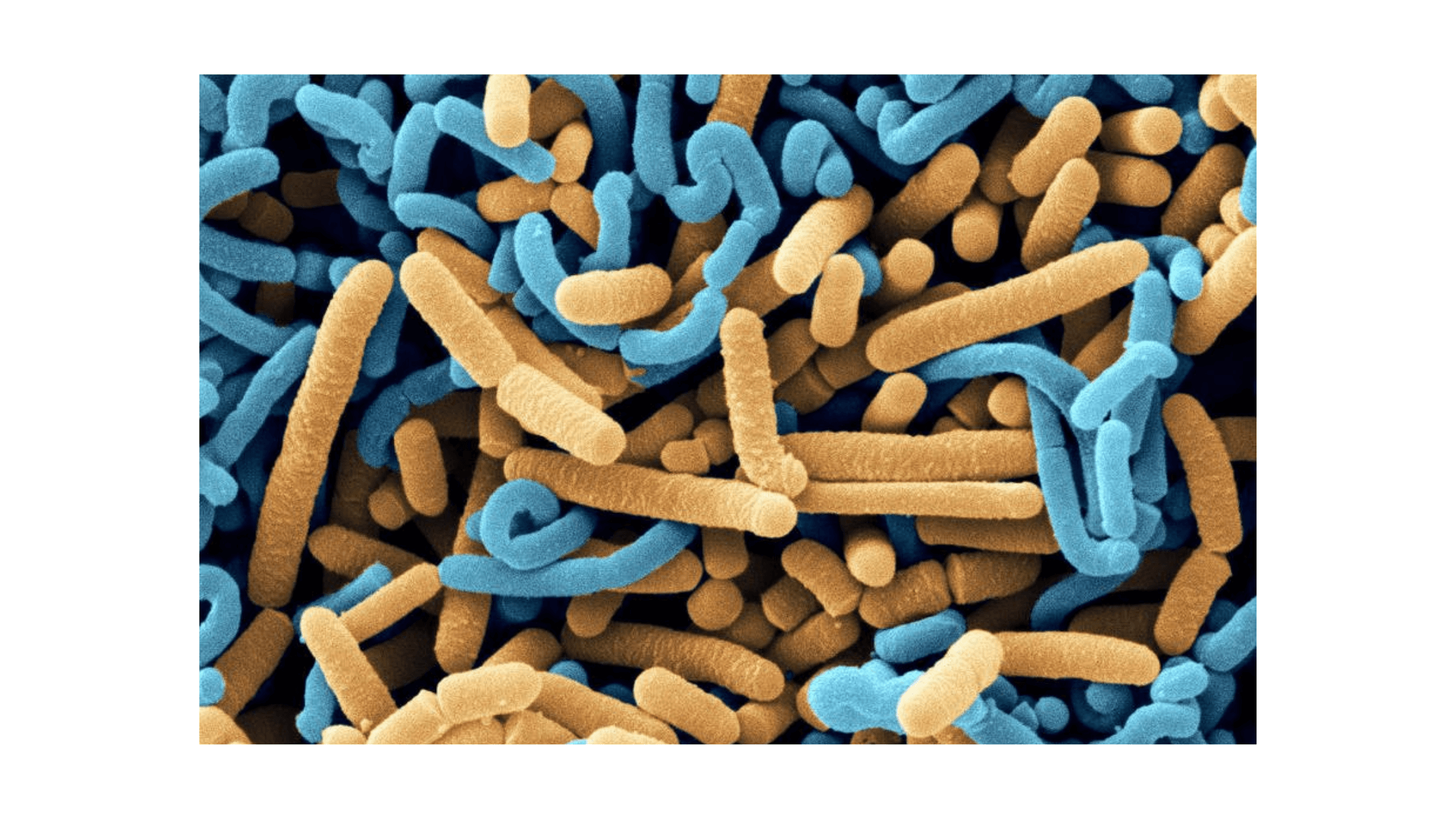 How Does Lactobacillus Acidophilus Protect The Gut 