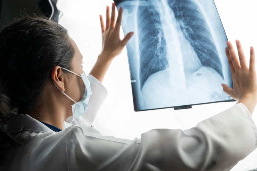Targeted High Dose Radiation To Help Severely Ill Lung Cancer Patients