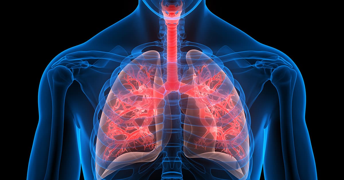 Seeing Good Survival Rates For Lung Cancer In Many People