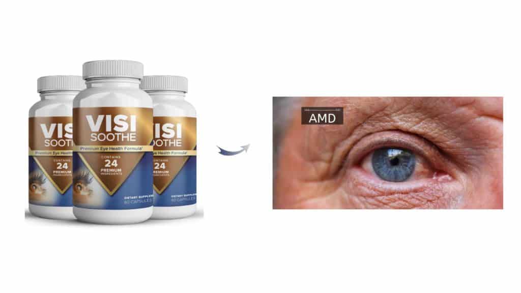 Visisoothe pill helps to treat age-related macular degeneration