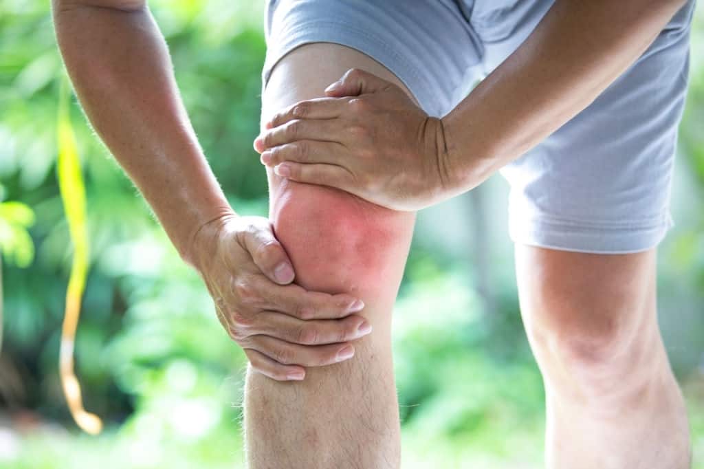arthritic knees
