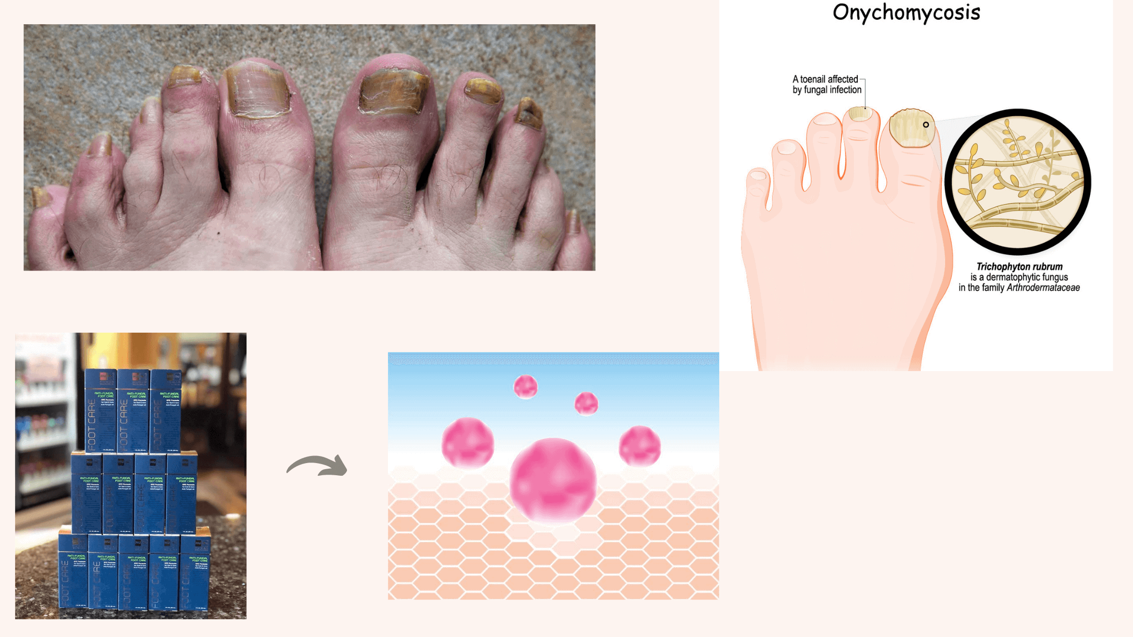 Human Science Antifungal Foot Care oil working