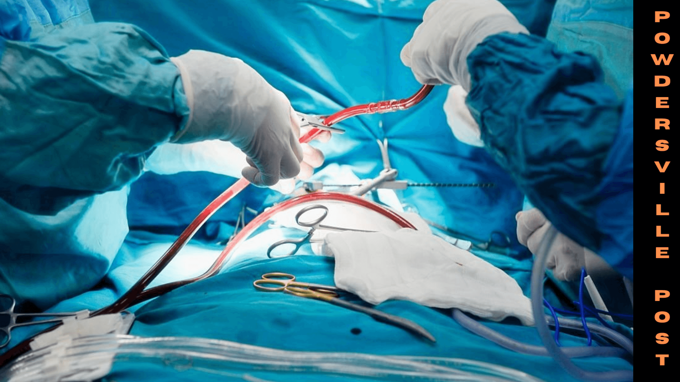 Patients With Mitral Valve Prolapse Can Avoid Fibrosis Through Surgery