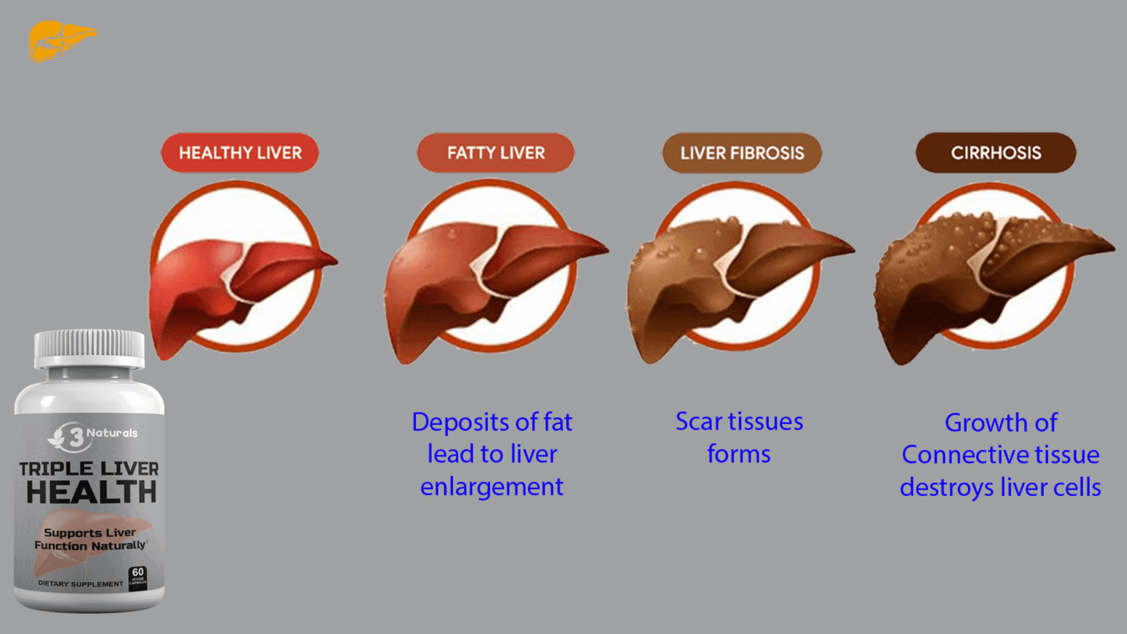 Triple Liver Health Working