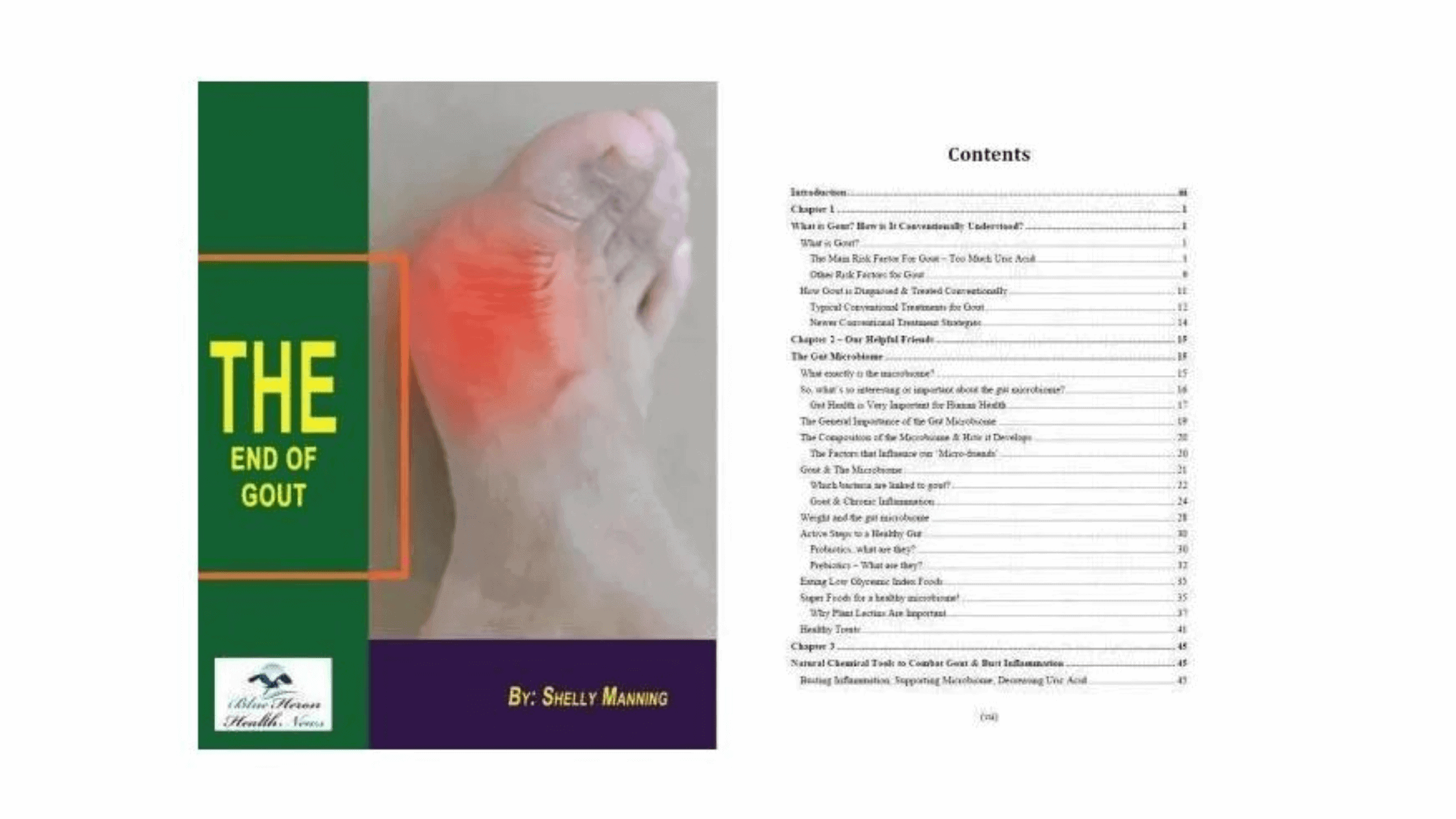 The End of Gout ebook