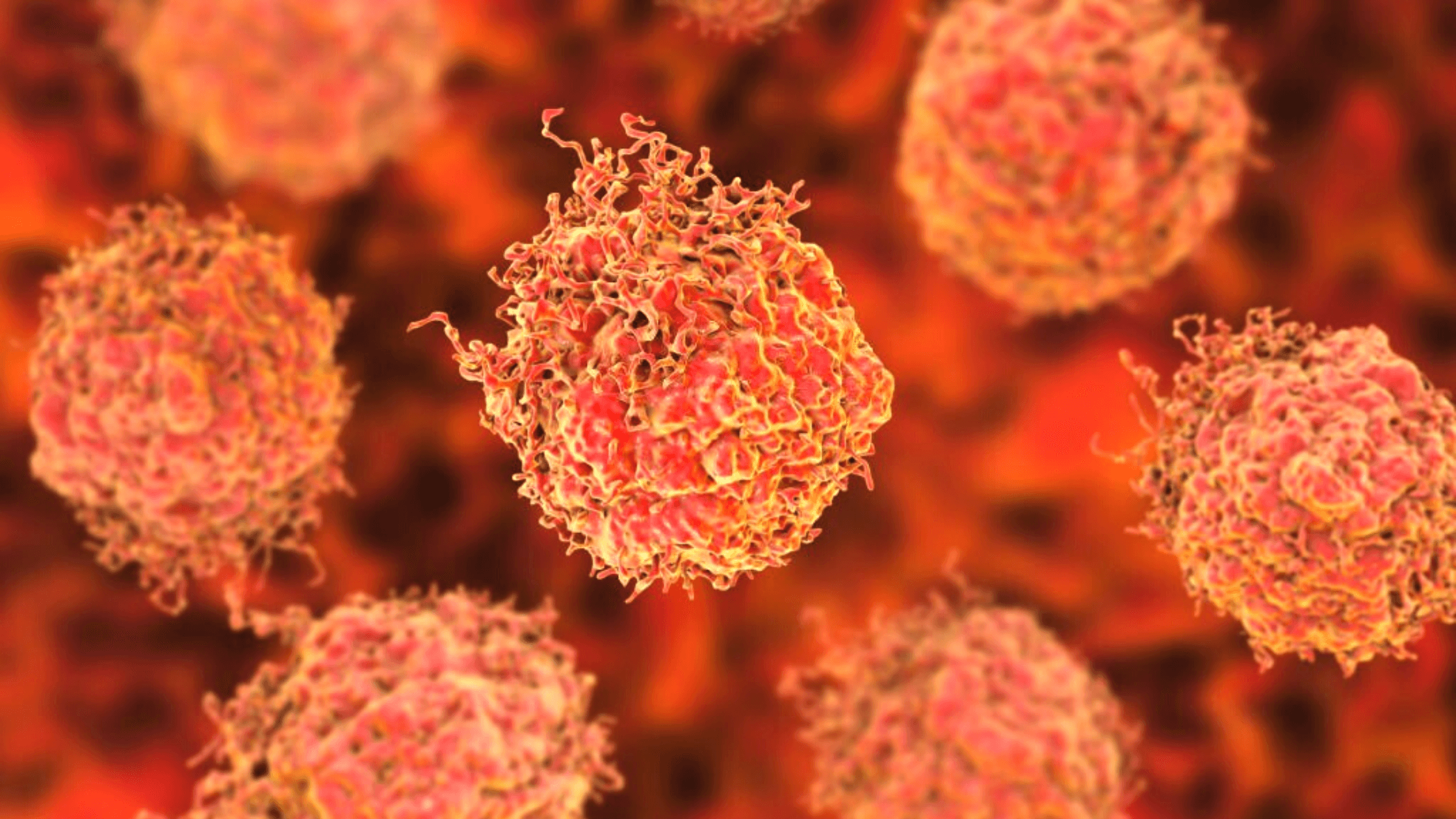 Common Subtype of Prostate Cancer Is Identified By Cornell Scientists