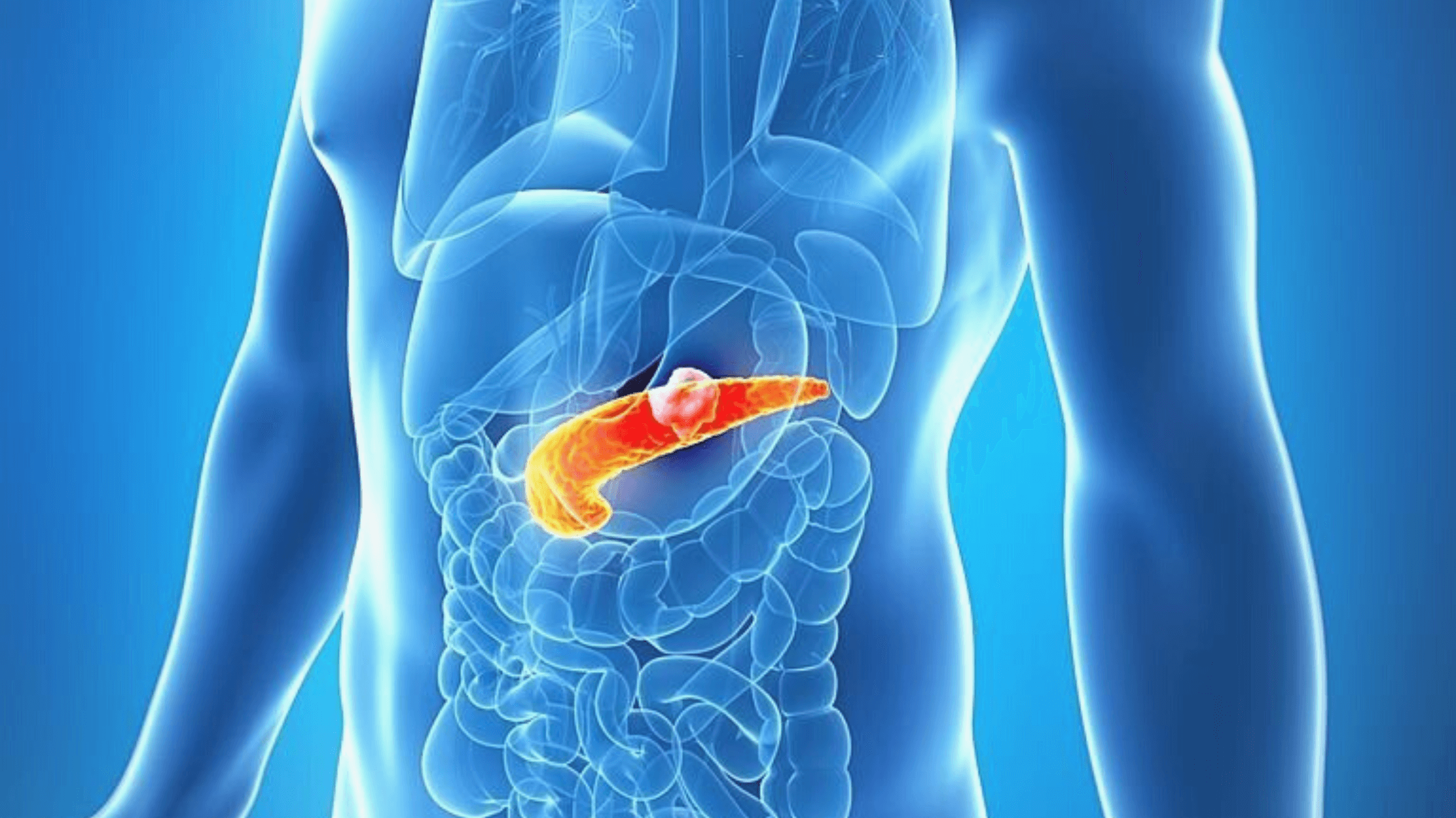 Pancreatic Cancer Important Role Of Regular Scan