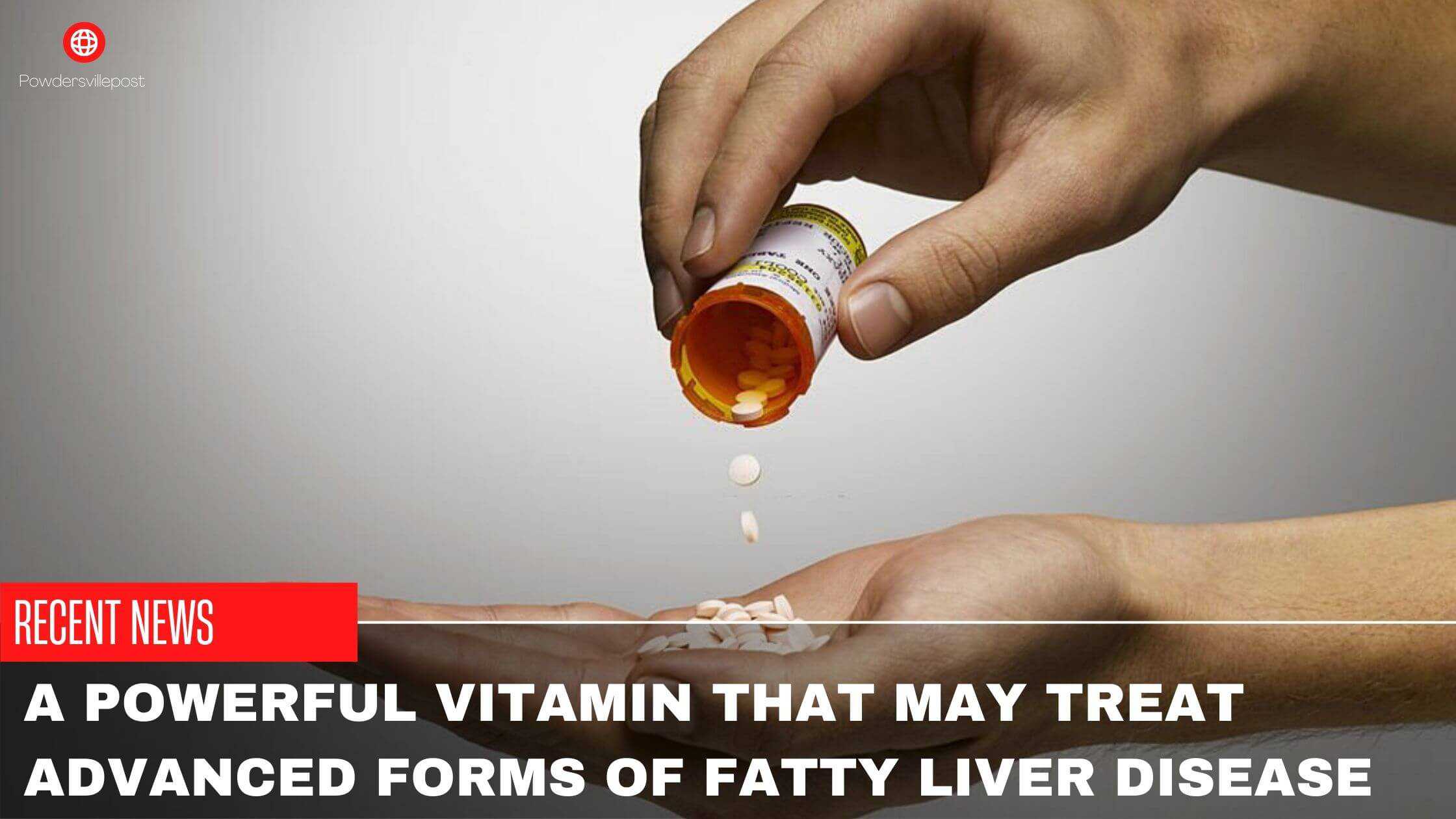 A Powerful Vitamin That May Treat Advanced Forms Of Fatty Liver Disease