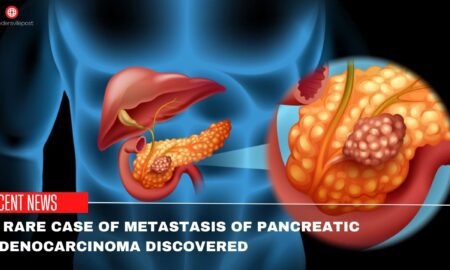 A Rare Case Of Metastasis Of Pancreatic Adenocarcinoma Discovered