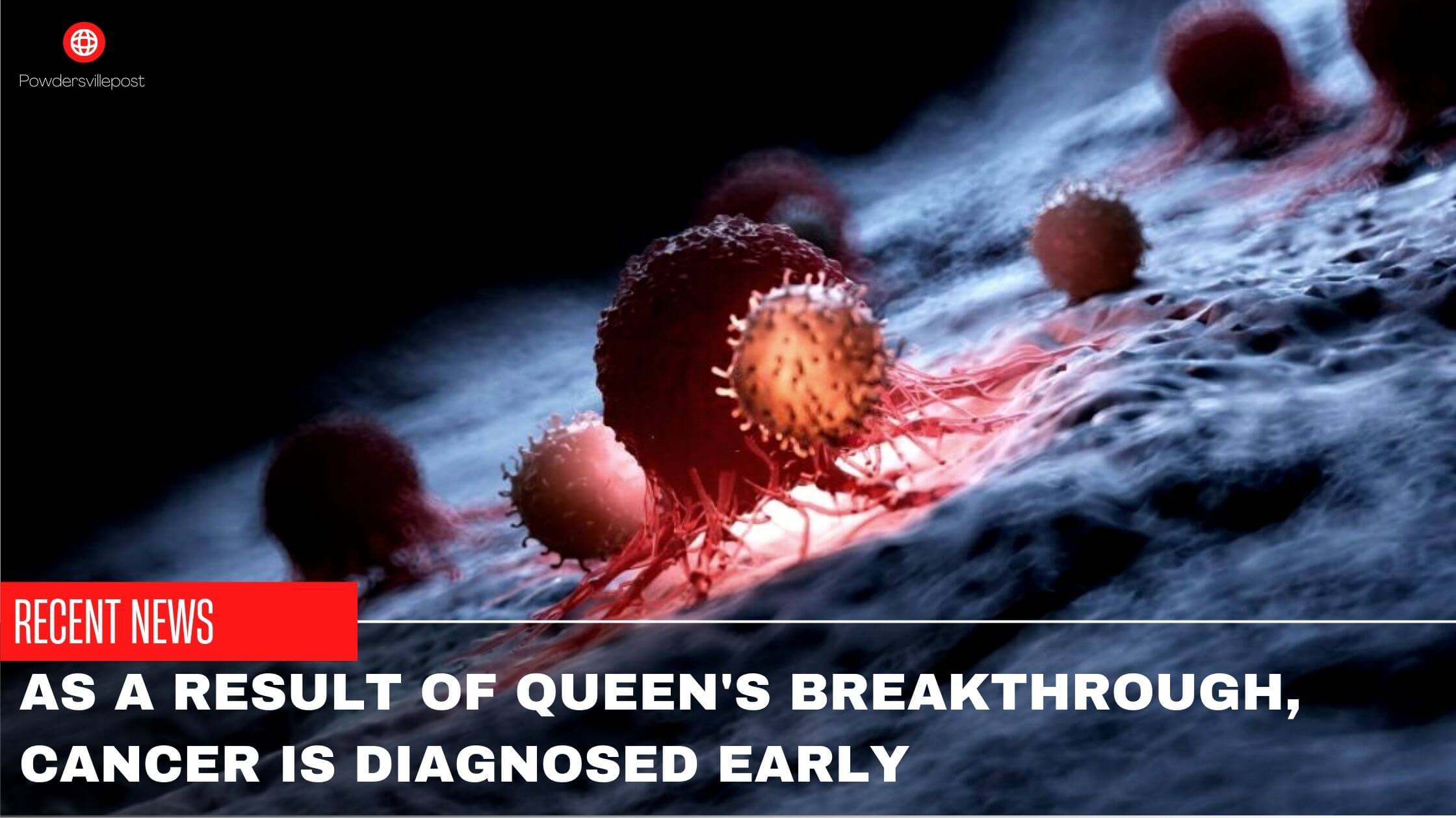 As A Result Of Queen's Breakthrough, Cancer Is Diagnosed Early