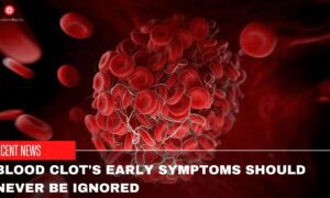 Blood Clot's Early Symptoms Should Never Be Ignored