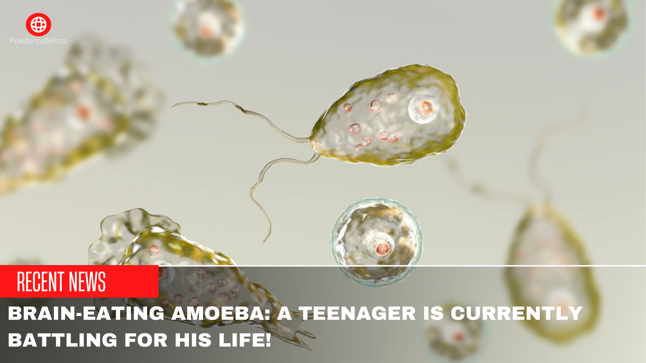 Brain-Eating Amoeba A Teenager Is Currently Battling For His Life!