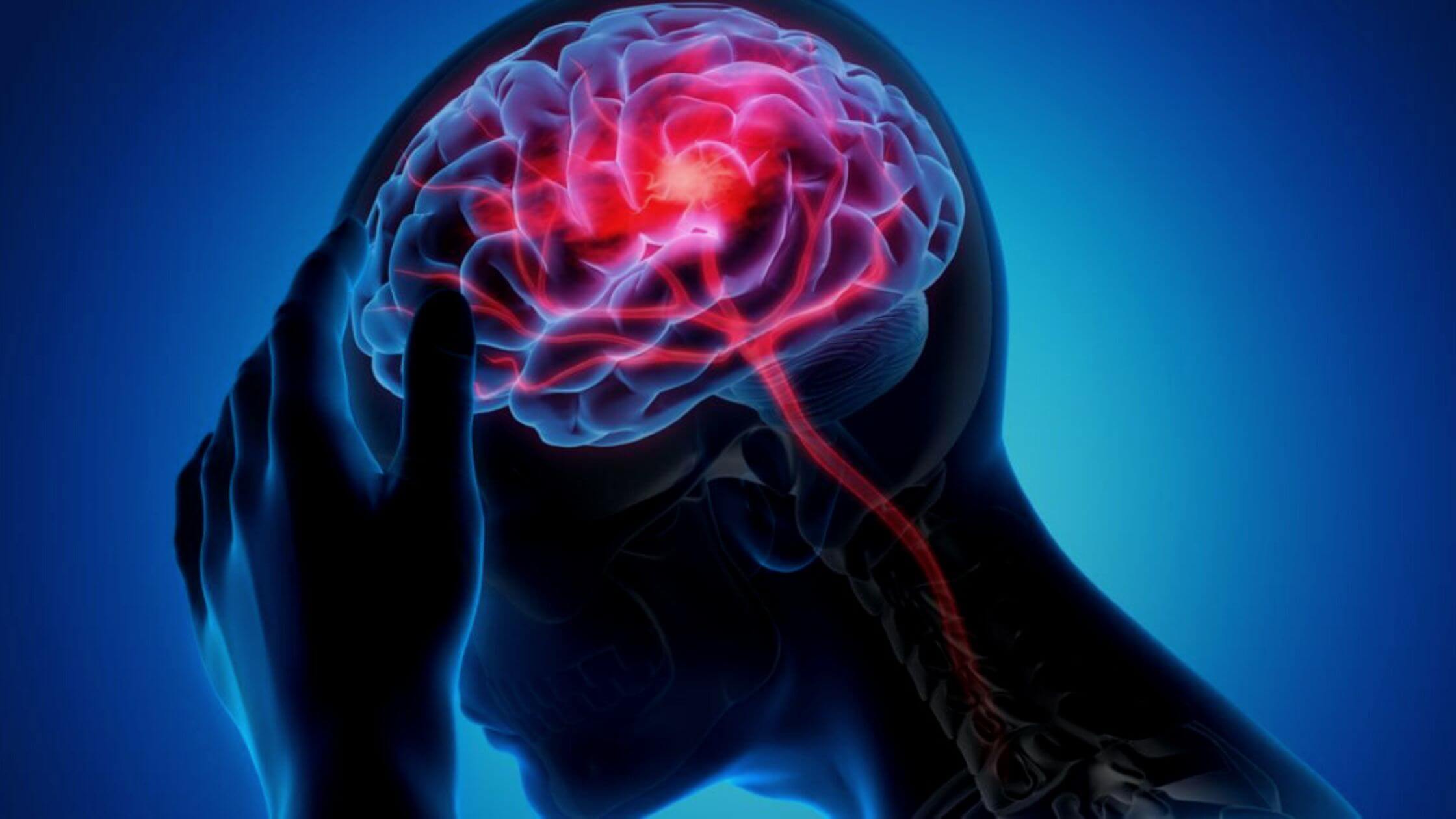 Cerebral Infarction In Conjunction With Acute Isolated Vertigo Effect