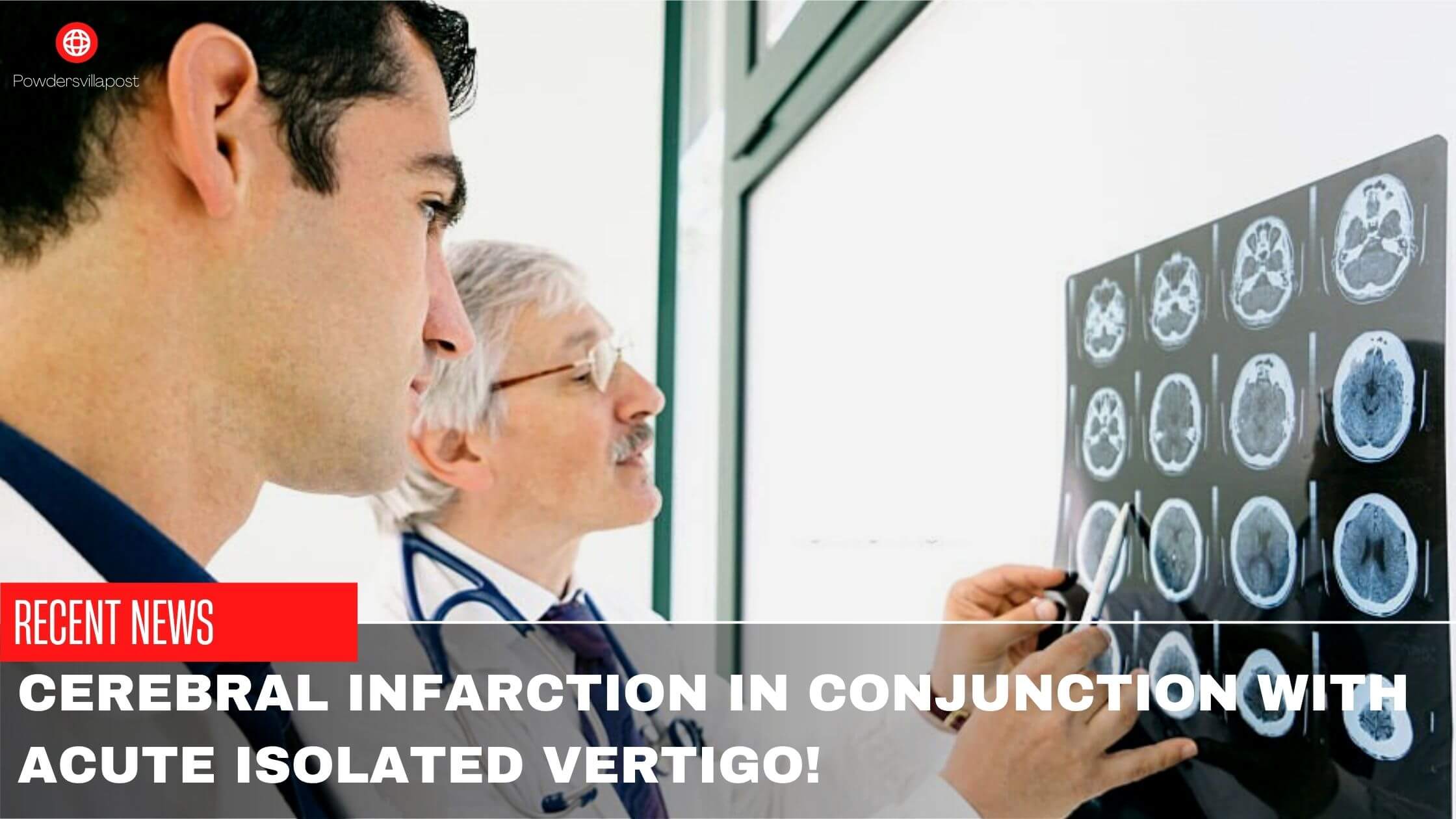 Cerebral Infarction In Conjunction With Acute Isolated Vertigo!