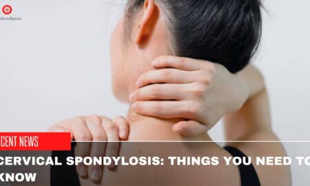 Cervical Spondylosis Things You Need To Know