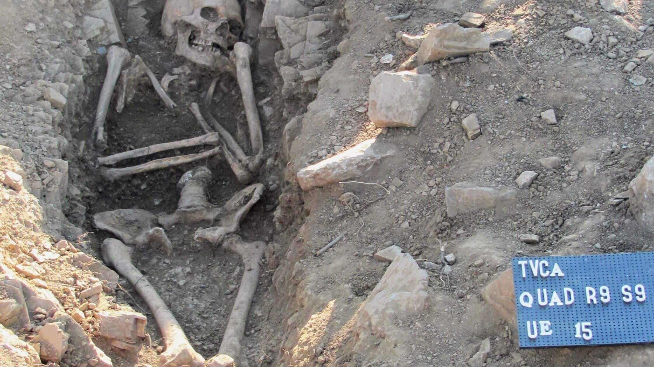 Ancient DNA From A Medieval Skeleton Reveals Klinefelter Syndrome