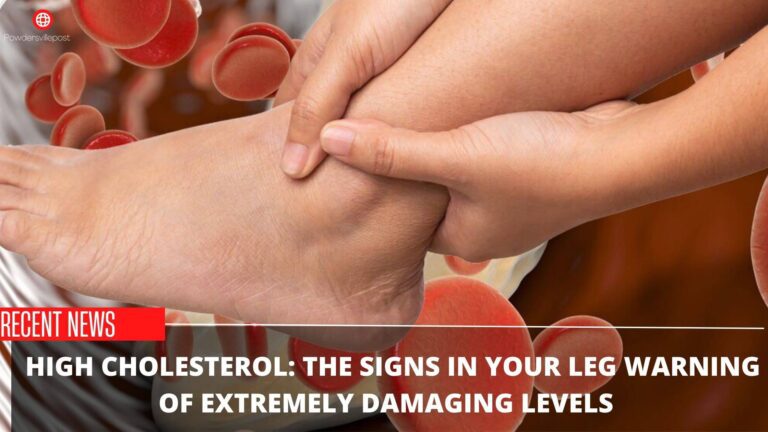 High Cholesterol: The Signs In Your Leg Warning Of Extremely Damaging Levels
