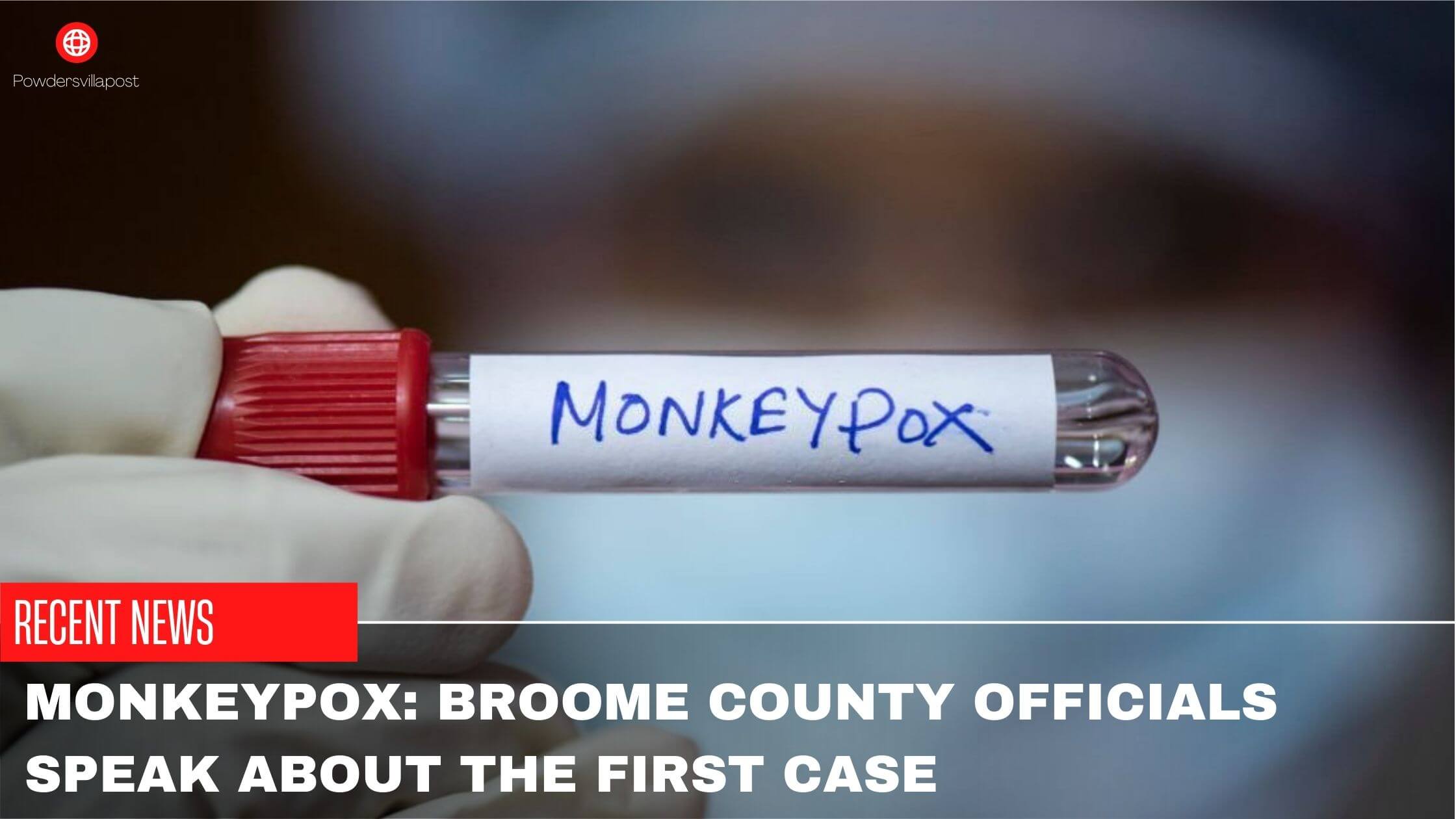 Monkeypox Broome County Officials Speak About The First Case