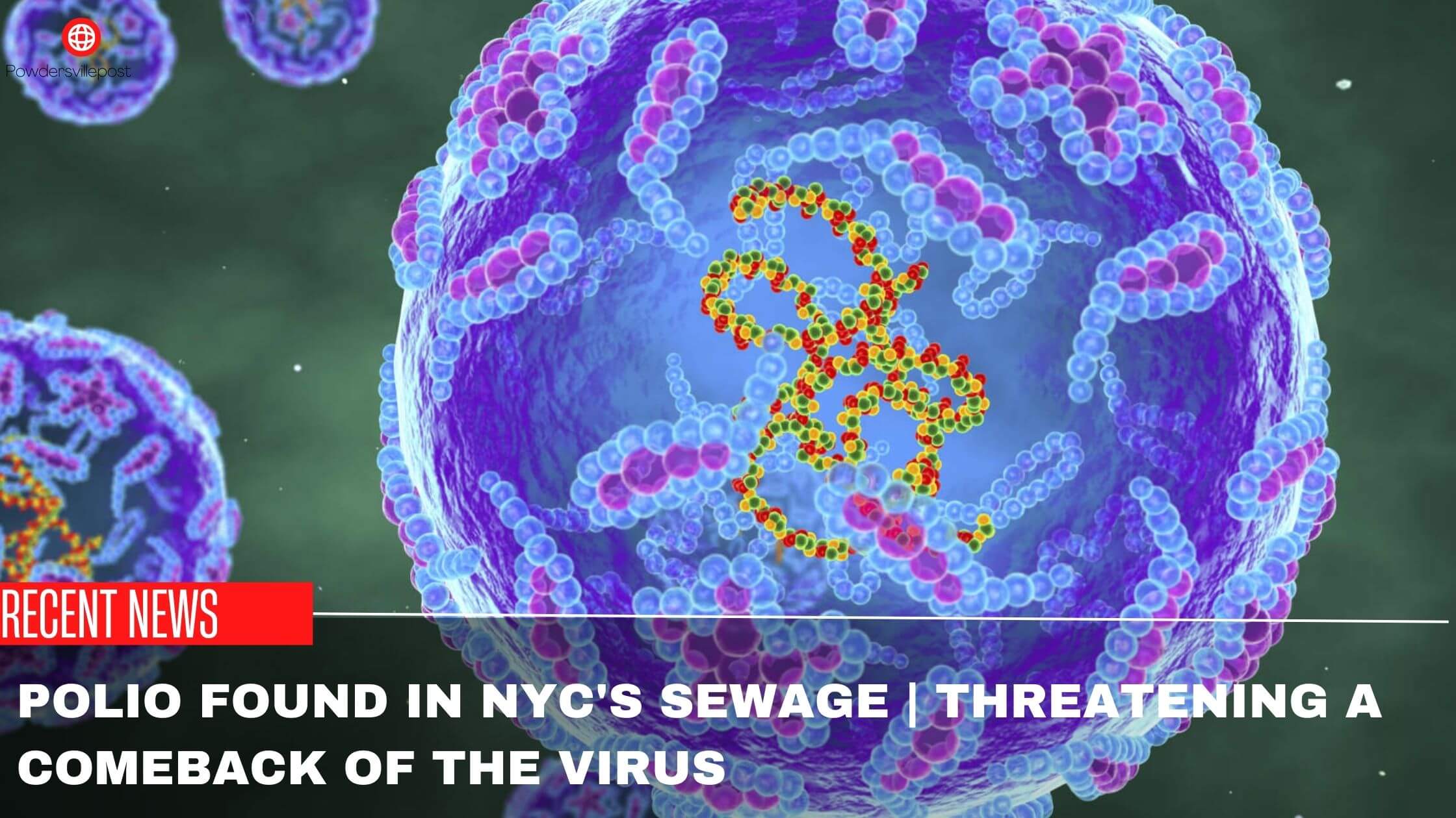 Polio Found In NYC's Sewage Threatening A Comeback Of The Virus