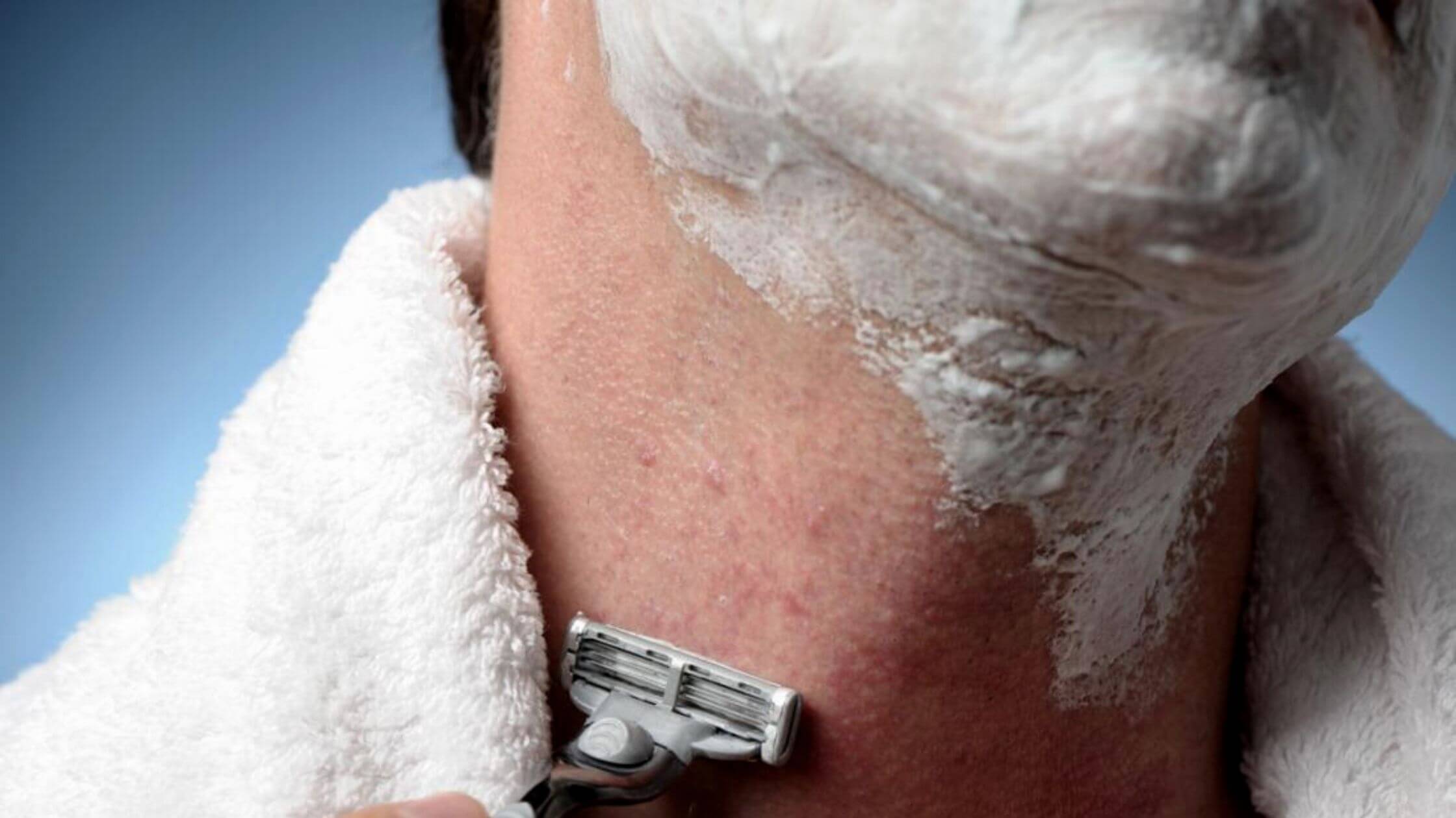 Razor Bump On The Body How To Get Rid Of It