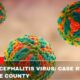 St. Louis Encephalitis Virus Case Reported In Tulare County