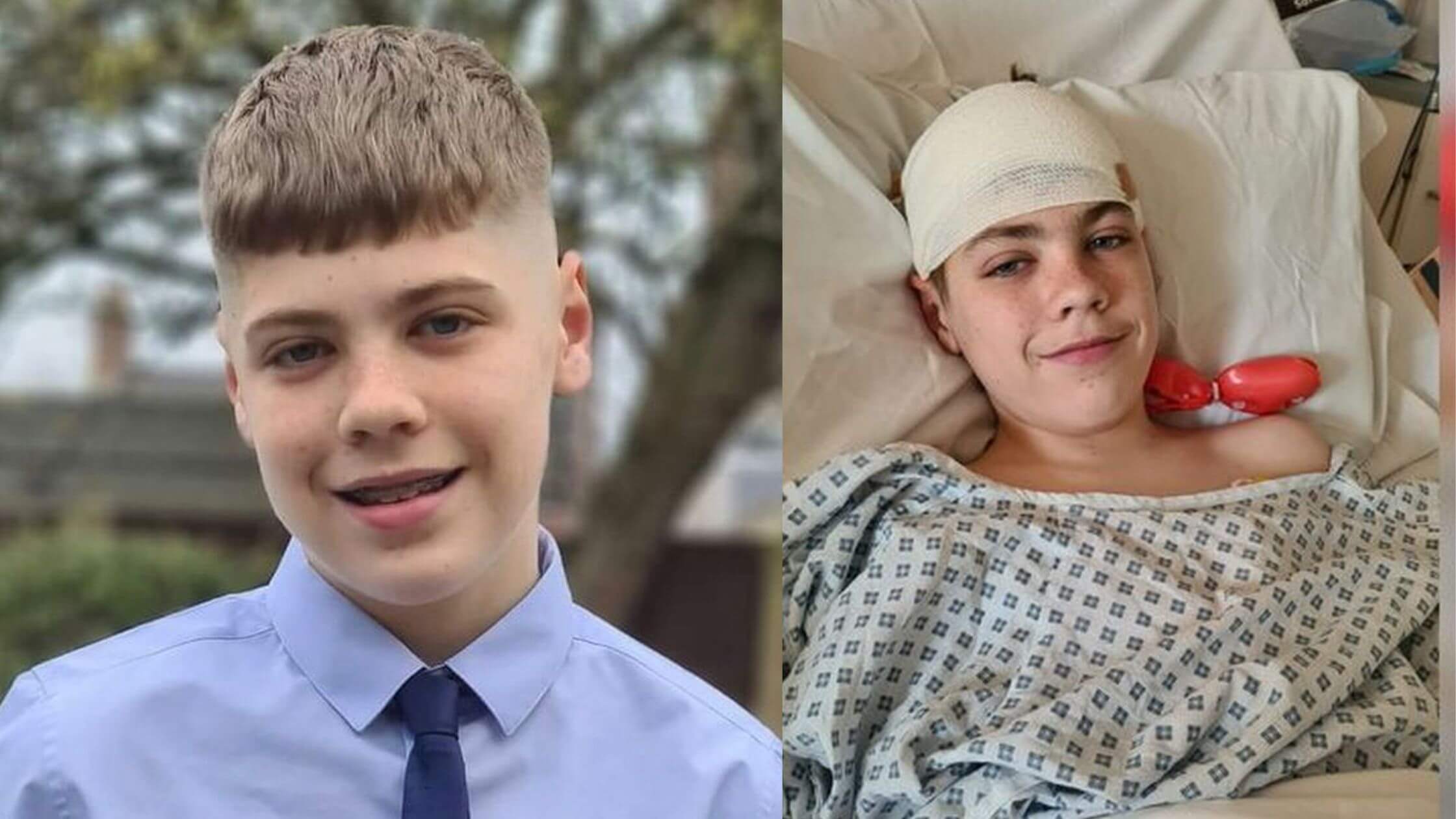 Teen Footballer Misdiagnosed  With A Long Covid Before Doctor Discover A Brain Tumor