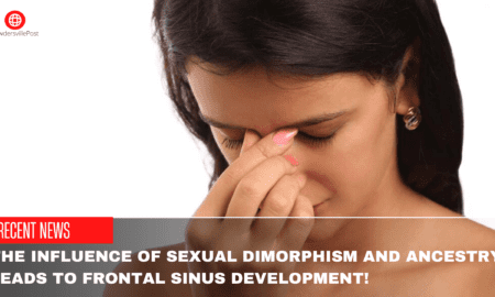 The Influence Of Sexual Dimorphism And Ancestry Leads To Frontal Sinus Development