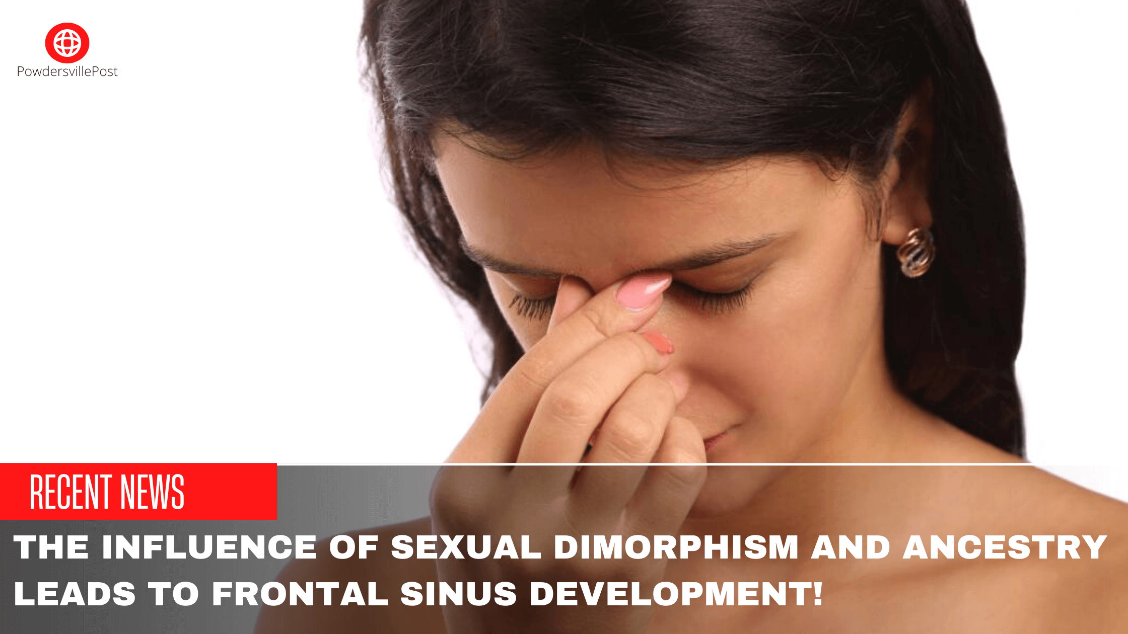 The Influence Of Sexual Dimorphism And Ancestry Leads To Frontal Sinus Development