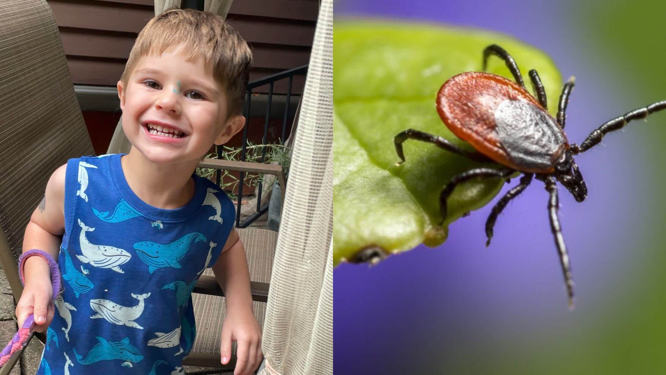 Three-Year-Old Hospitalized After Contracting A Tick-Borne Virus How