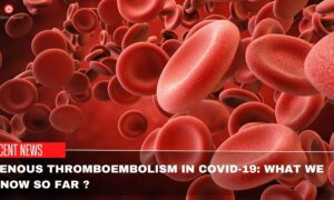 Venous Thromboembolism In COVID-19 What We Know So Far