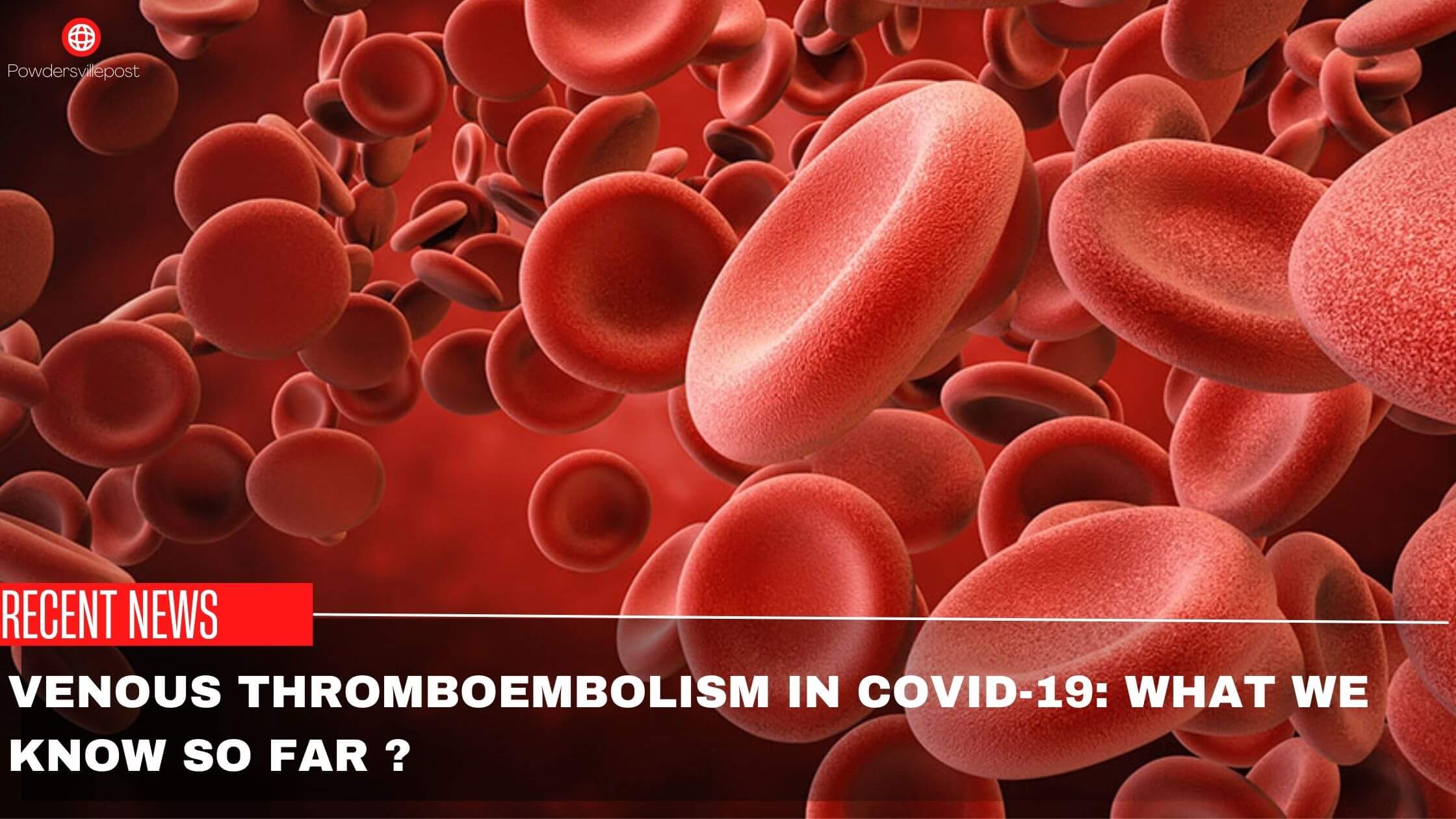Venous Thromboembolism In COVID-19 What We Know So Far