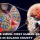 West Nile Virus First Human Case Reported In Solano County