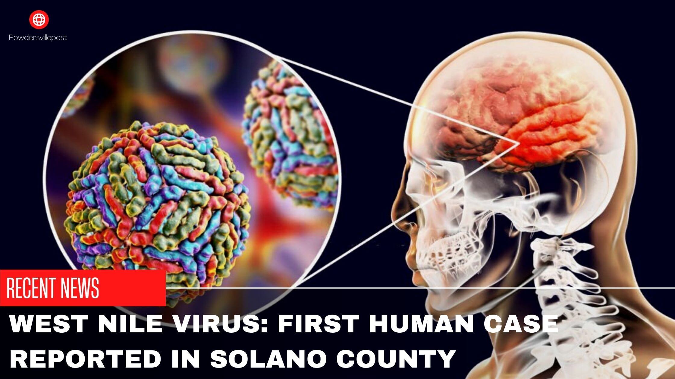 West Nile Virus First Human Case Reported In Solano County