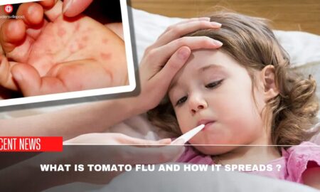 What Is Tomato Flu And How It Spreads