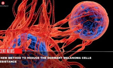 A New Method To Reduce The Dormant Melanoma Cells Resistance Recent Findings