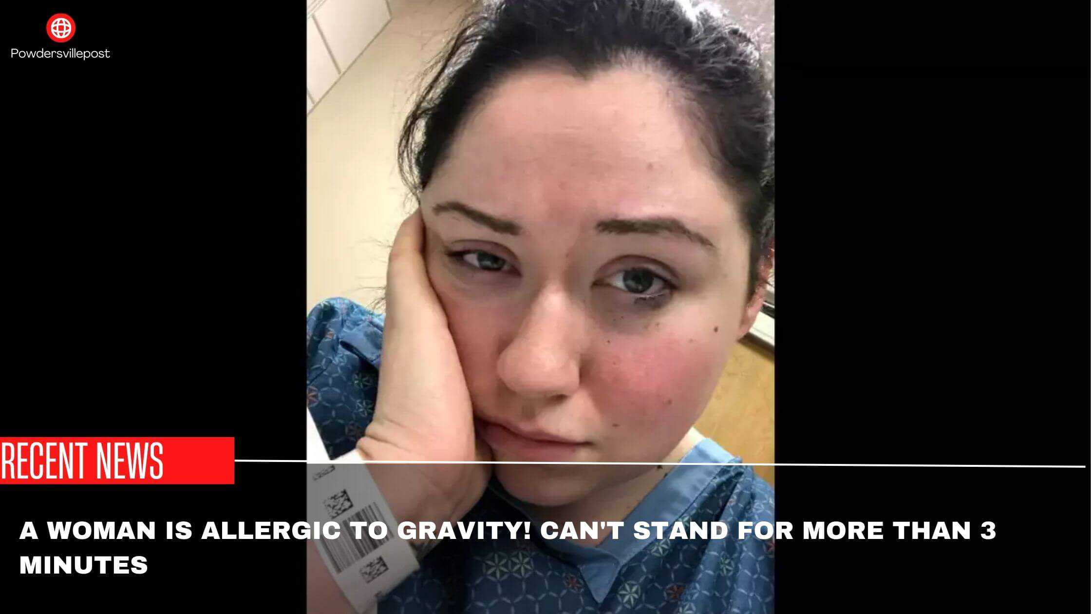 A Woman Is Allergic To Gravity! Can't Stand For More Than 3 Minutes