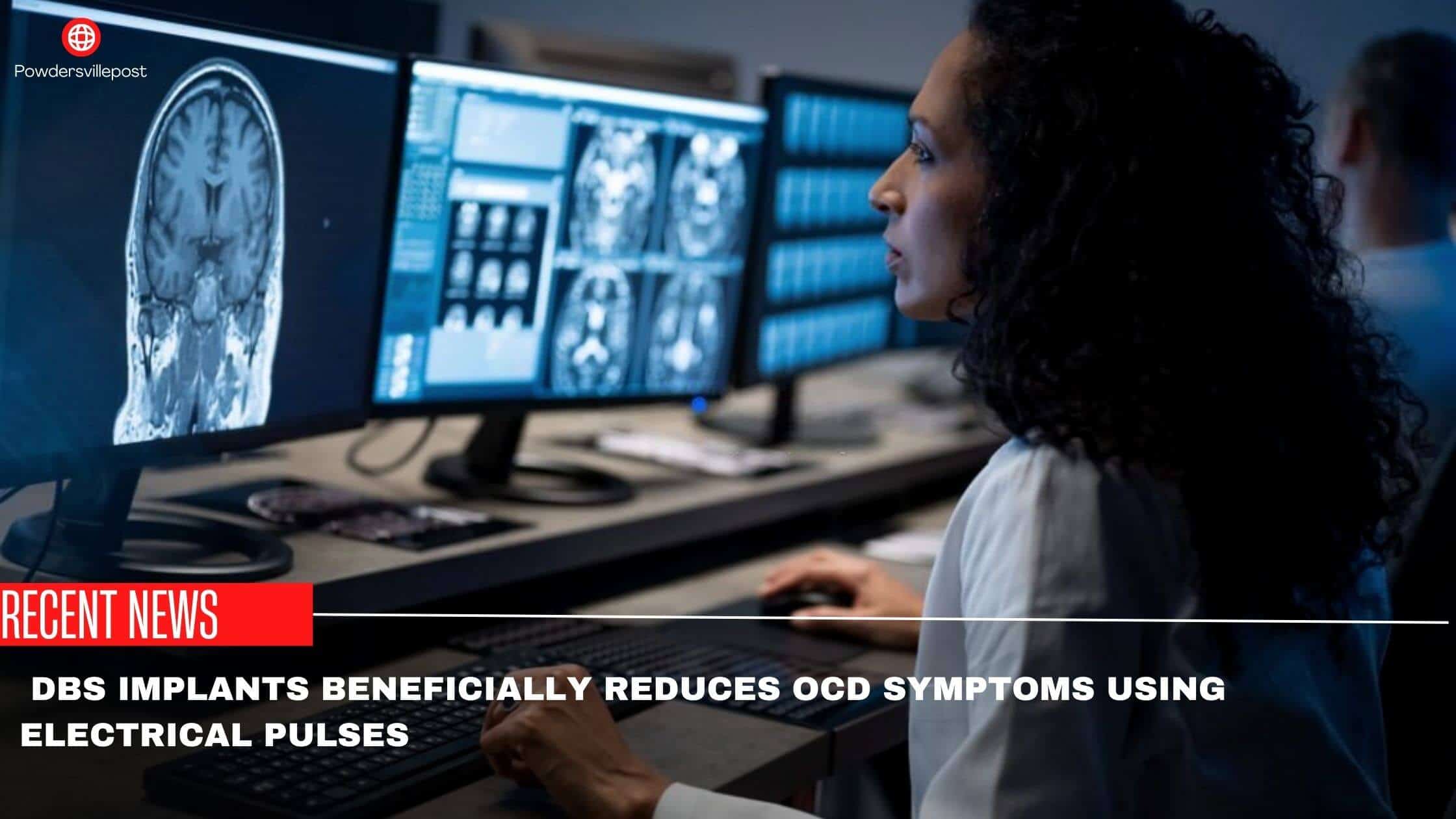 DBS Implants Beneficially Reduces OCD Symptoms Using Electrical Pulses