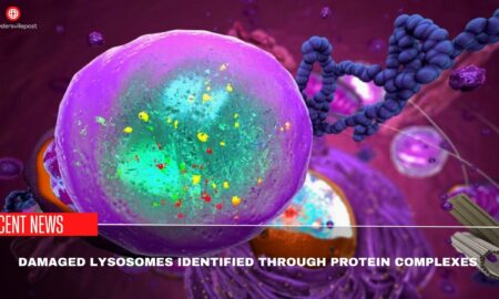 Damaged Lysosomes Identified Through Protein Complexes Study